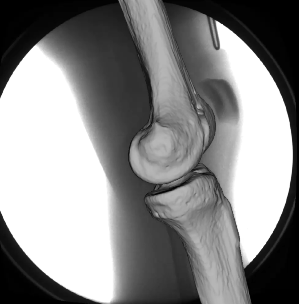 Enlarged view: healthy knee