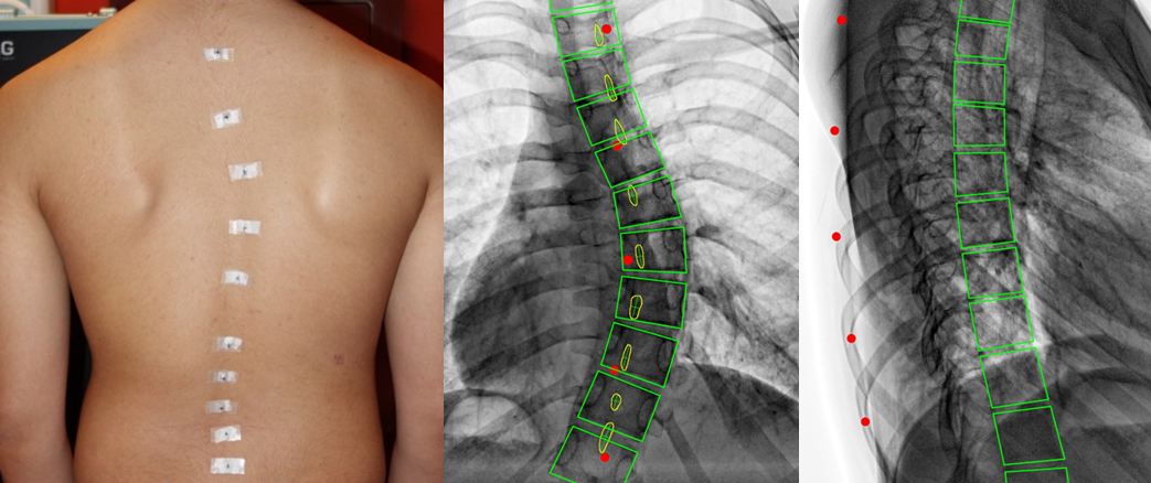 Spine Dynamics Laboratory For Movement Biomechanics Eth Zurich